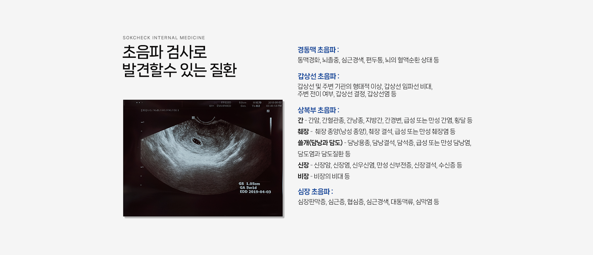 초음파 검사로 발견할수 있는 질환
